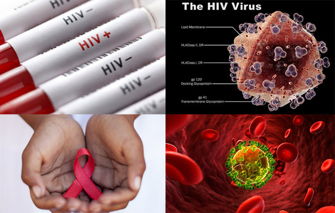 ciri-ciri penyakit hiv aids adalah