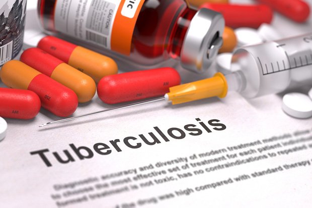 Read more about the article Kelompok Sebaya Dukung Kepatuhan Pengobatan Pasien TB Paru