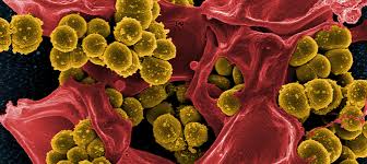 Read more about the article Menelisik Perbandingan Kolonisasi Staphylococcus Aureus