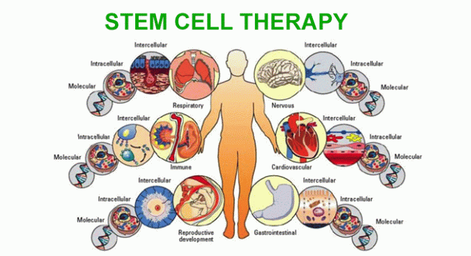 Read more about the article Treating Bone Damage with Stem Cells