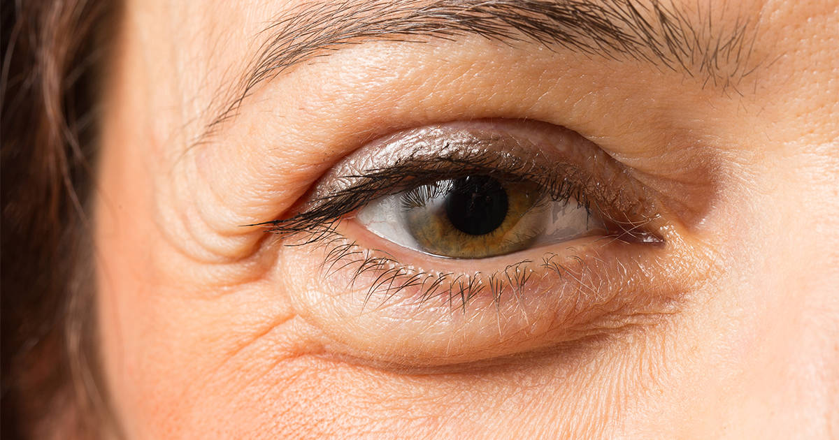 Read more about the article Identifikasi Glukoma pada Fundus Retinal Images dengan Pendekatan Pemodelan Statistika