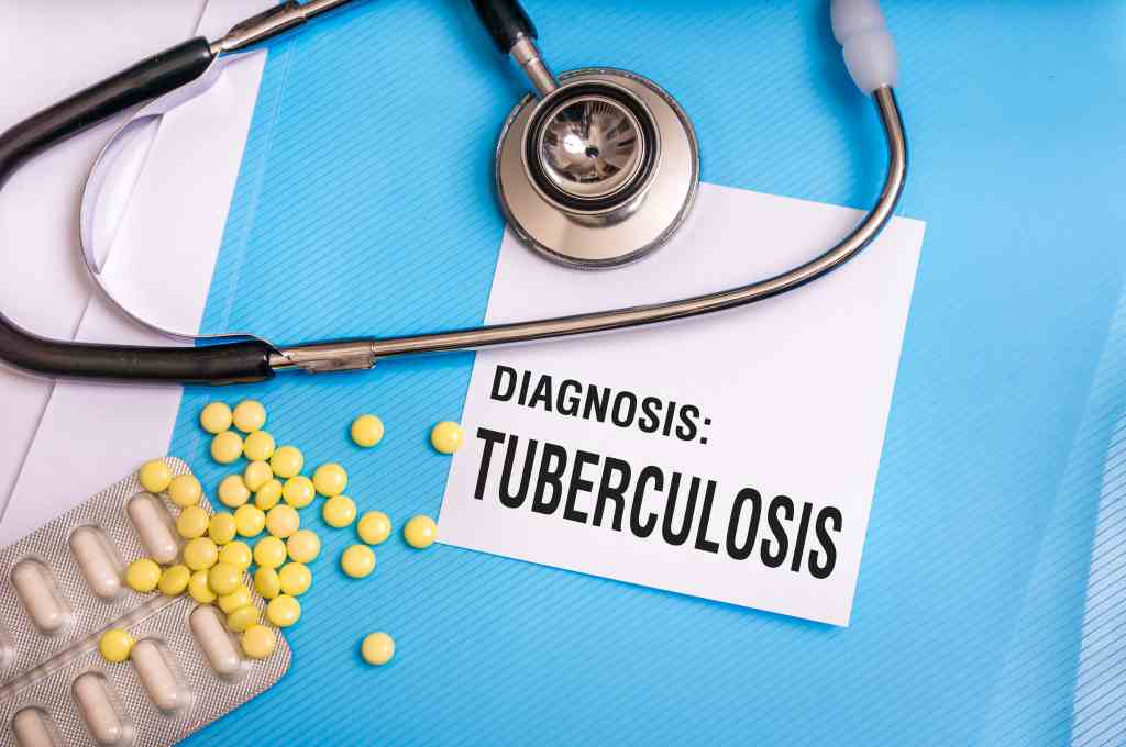 Read more about the article Pemantauan Minum Obat anti-TBC berdasar Penurunan Jumlah Basil Tahan Asam