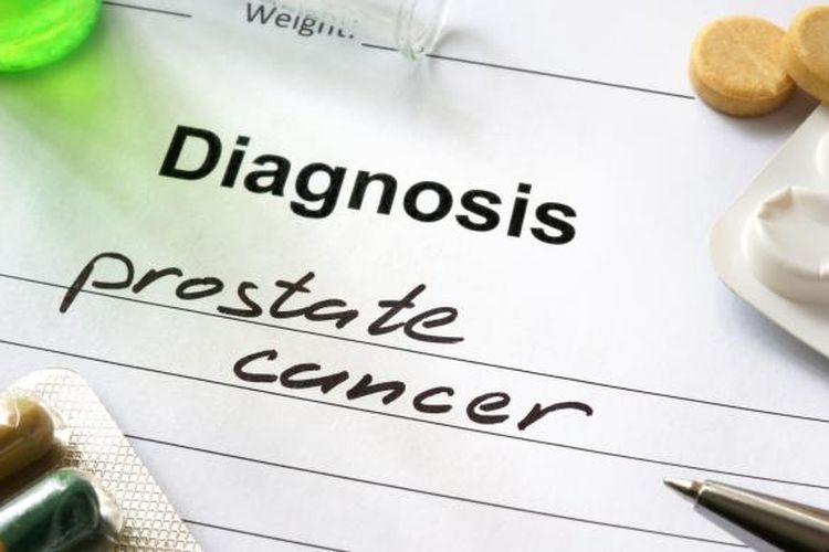 Read more about the article Pemanfaatan Protein Bakteri Probiotik untuk  Pencegahan Tumor Prostat