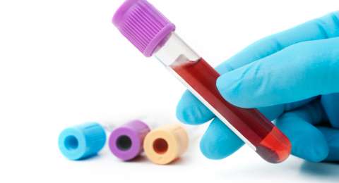 Read more about the article Pentingnya Kualitas Sampel Darah