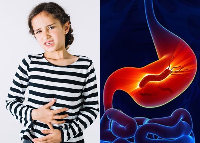 Read more about the article Helicobacter pylori infection in children