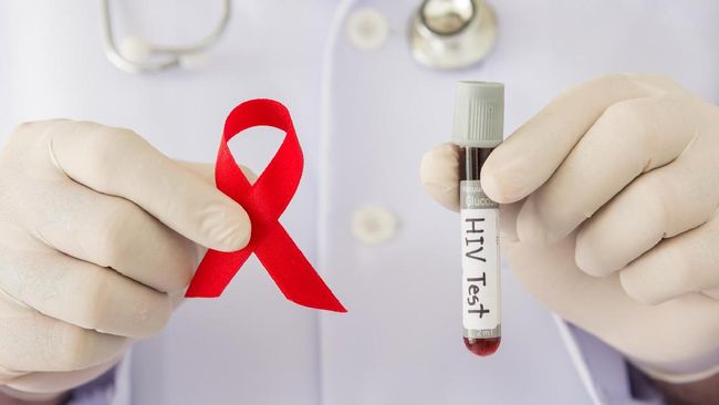 Read more about the article Manifestasi Patognomonik Penyakit Periodontal pada Penderita HIV/AIDS