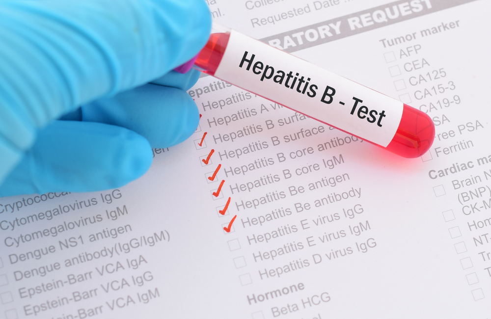 Read more about the article Evaluasi Terapi Lamivudin dan Telbivudin pada Pasien Hepatitis B Kronis di RSUD Soetomo