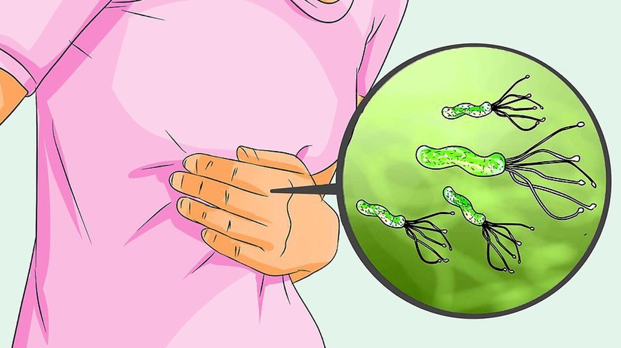 Read more about the article Hubungan Infeksi Helicobacter Pylori dengan Tingkat Serum Gastrin-17