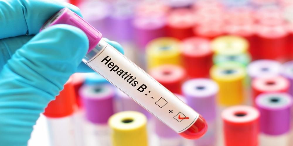 Read more about the article Evaluasi Terapi Lamivudin dan Telbivudin pada Pasien Hepatitis B Kronis