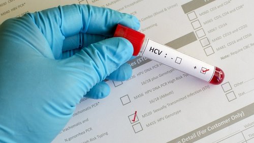 Read more about the article Prevalence and genotype distribution of hepatitis B virus in Indonesian migrant workers from Lombok Island