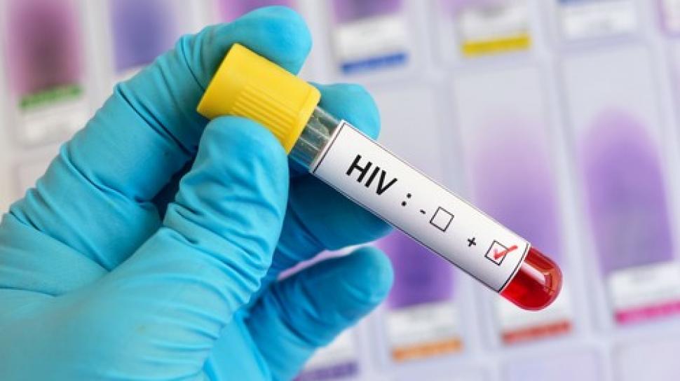 Read more about the article Supportive Educative Intervention untuk Kepatuhan Terapi Antiretroviral dan Kualitas Hidup Pasien HIV