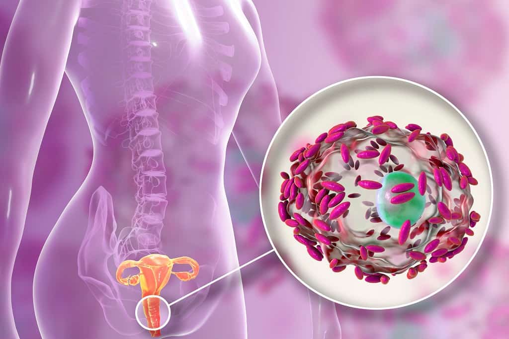 Mengenal Vaginosis Bakterial - Unair News