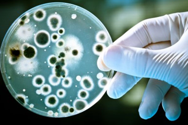 Read more about the article Gubes UNAIR Paparkan Ancaman Global Resistensi Antimikroba