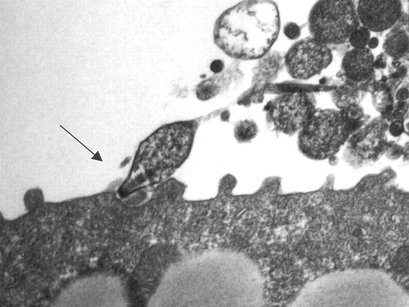 Read more about the article Genom Mycoplasma pneumoniae dan Mycoplasma genitalium, Patogen Kecil yang Unik