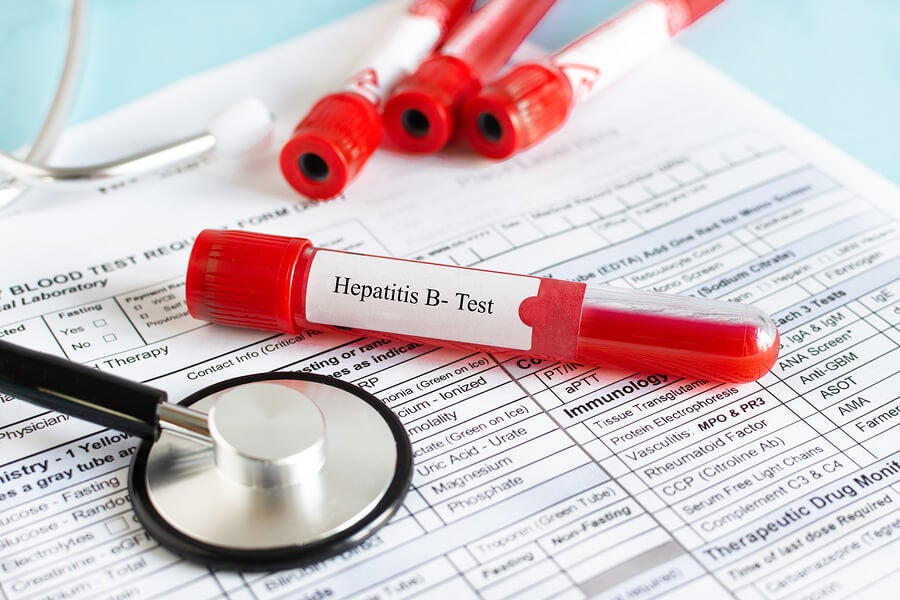 Read more about the article Mutasi PreS Virus Hepatitis B Sebagai Faktor Risiko Kanker Hati
