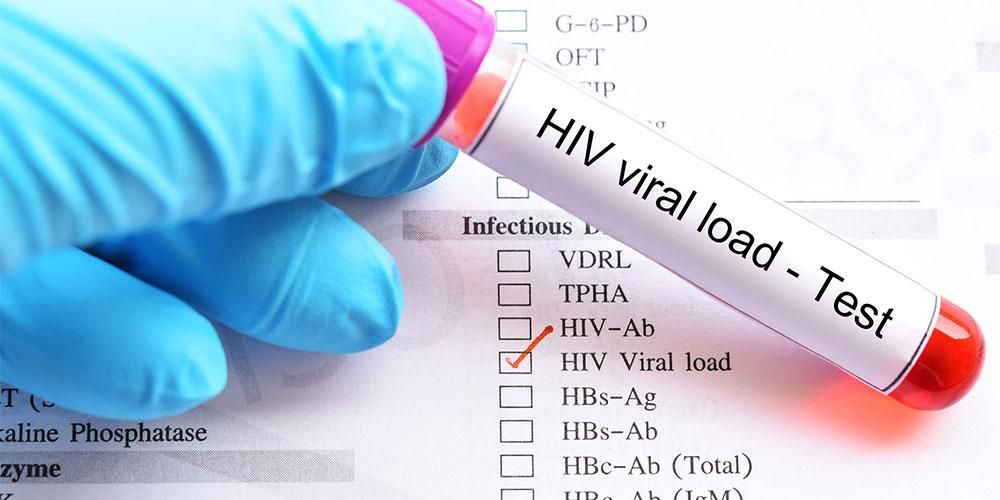 Read more about the article Tes Viral Load HIV Masih Mahal, Adakah Alternatifnya?
