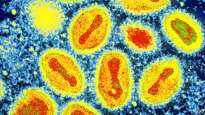 Read more about the article Kasus Dugaan Infeksi Monkeypox pada Orang Dewasa dengan Diagnosa Banding Chickenpox