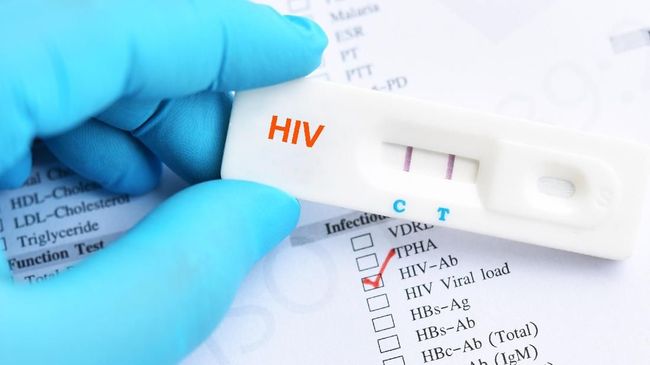 Read more about the article Peluang Immunoglobulin Y (IgY) Spesifik Anti HIV-1 untuk Menghambat Infeksi HIV