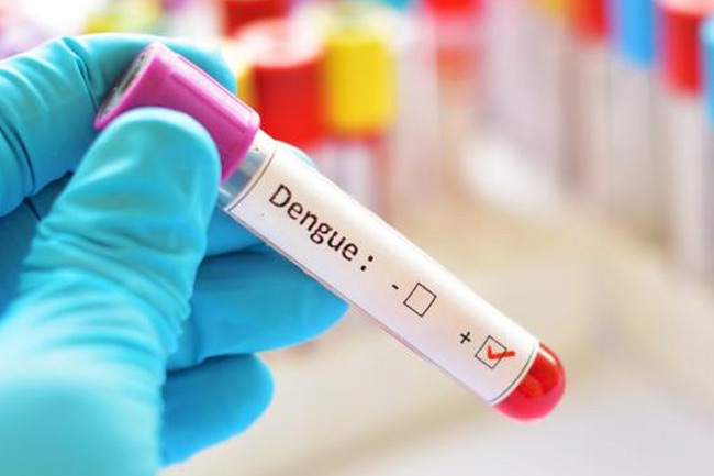 Read more about the article Prevalensi Expanded Dengue Syndrome pada Pasien Infeksi Virus Dengue di RSUD Dr. Soetomo Tahun 2017-2018