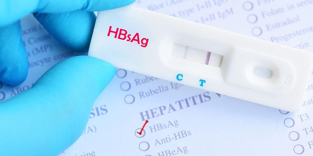Read more about the article Association between HBx gene variation and severe disease development in Hepatitis B patients