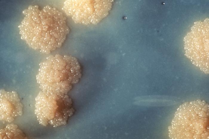 Read more about the article Cloning Gen fbpA dan fbpB Mycobacterium Tuberculosis dari Isolat Klinik dan Ekspresi Protein, Serta Prediksi Epitop Sel Limfosit T