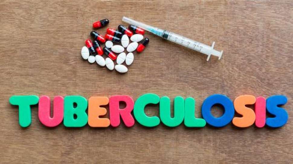 Read more about the article Tuberkulosis Resistant Obat: Hubungan antara Kepositifan Sputum Bakteri Tahan Asam dan Waktu Konversi pada Pasien dengan Regimen Short-Term Treatment