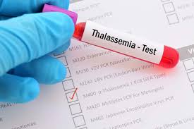 Read more about the article Peer-based Thalassemia education online amid COVID-19 pandemic