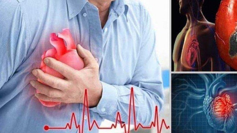Read more about the article Hipertensi Arteri Pulmoner pada Penyakit Jantung Kongenital