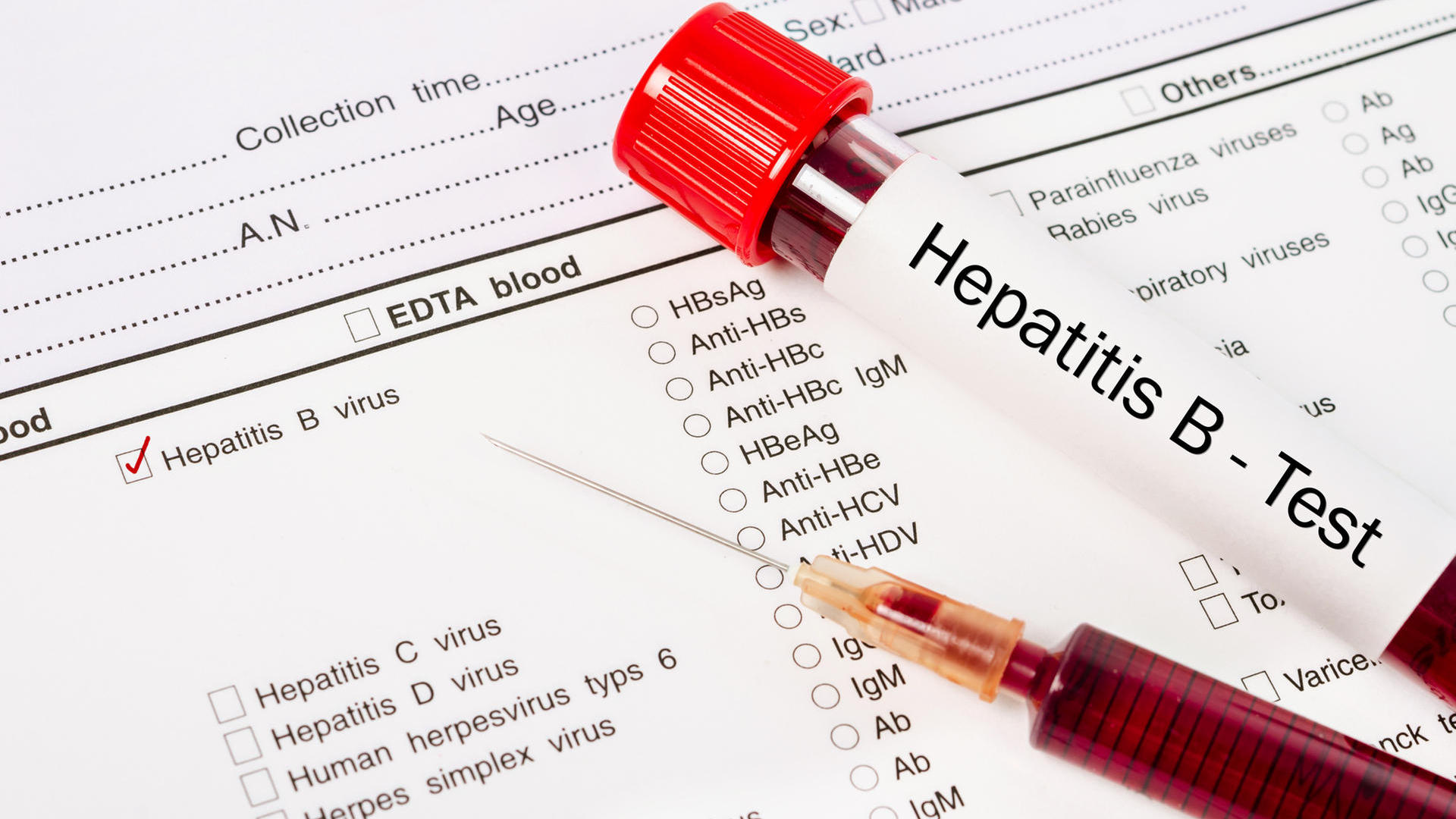 Read more about the article Peranan P53, Transforming Growth Factor Beta-1, dan Interleukin-10 dengan Penyakit Hati Tahap Lanjut pada Pasien Hepatitis B