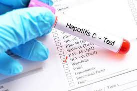 Read more about the article Beberapa Jenis Virus Hepatitis C yang Terdeteksi pada Penderita Pengguna Narkoba