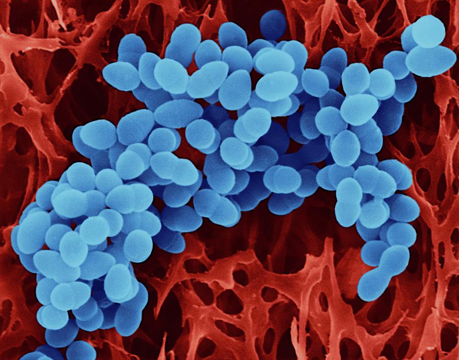 Read more about the article Profil Mutasi Genetik rpoB pada Isolat Klinik Staphylococcus aureus yang Resistan Rifampisin
