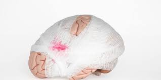 Read more about the article Rekonstruksi Model Cetak 3D dalam Perencanaan Pra-Operasi untuk Cedera Otak Tembus Kayu