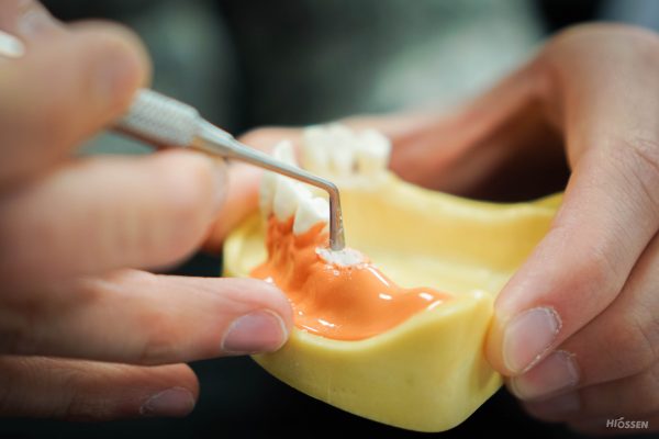 Read more about the article Penggunaan Demineralized Dentin Material Sponge sebagai Alternatif Bahan Guided Bone Regeneration