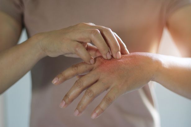 Read more about the article Pencegahan Dermatitis Kontak karena Kebersihan Tangan di Era COVID-19