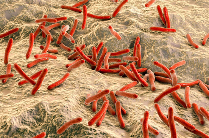 Read more about the article Mampukah Manusia Bertahan dalam Menghadapi Dinamika Agen Infeksi Bakteri