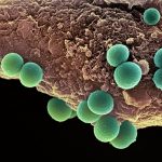 Mengenal Bakteri Staphylococcus aureus yang Resisten dan Sensitif Metisilin serta Respon Penghambatan Mereka oleh Ekstrak Etanol dari Tanaman Saga