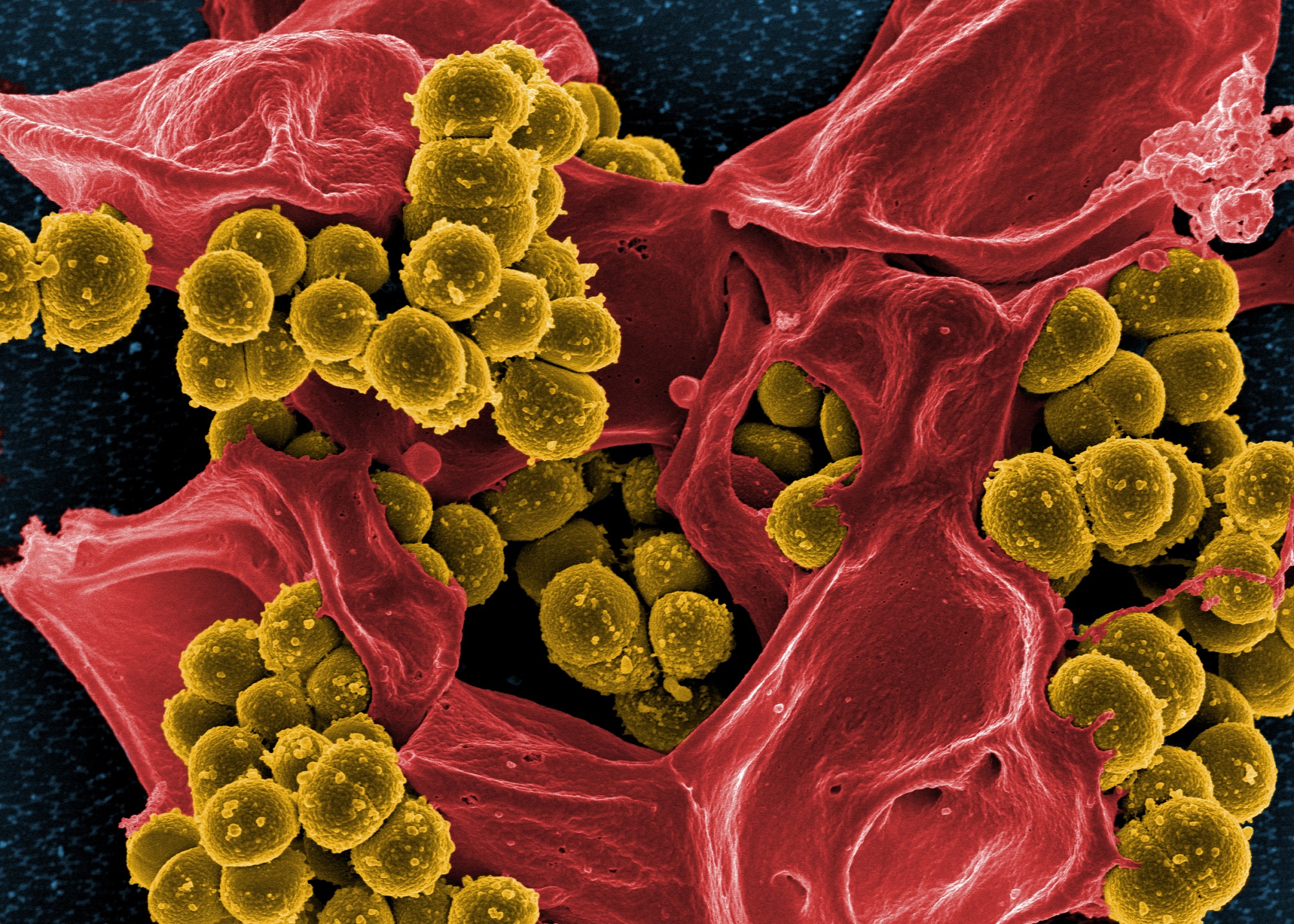 Read more about the article Karakterisasi Molekuler, Determinan Virulensi, dan Profil Resistensi Antimikroba Staphylococcus aureus yang Tahan Methicillin