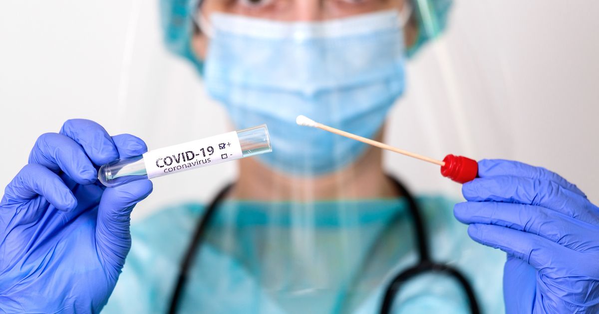 Read more about the article Gambaran Epidemiologi Kasus Infeksi COVID-19